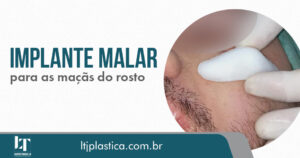 cirurgia plástica são paulo implante malar